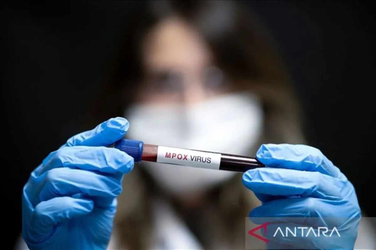 Pria Berusia 61 Tahun Meninggal Akibat Mpox di Spanyol, Kewaspadaan terhadap Penyakit Menular Ditingkatkan